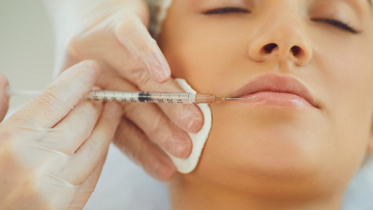 ualouroniko-katarriptoume-4-muthous-gia-to-lip-filler