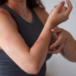 allergies-nyxia-odigos-texnites